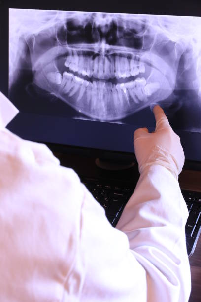 Best Emergency Tooth Extraction in Newfield, NJ